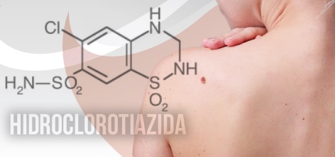A relação entre Hidroclorotiazida e o câncer de pele.